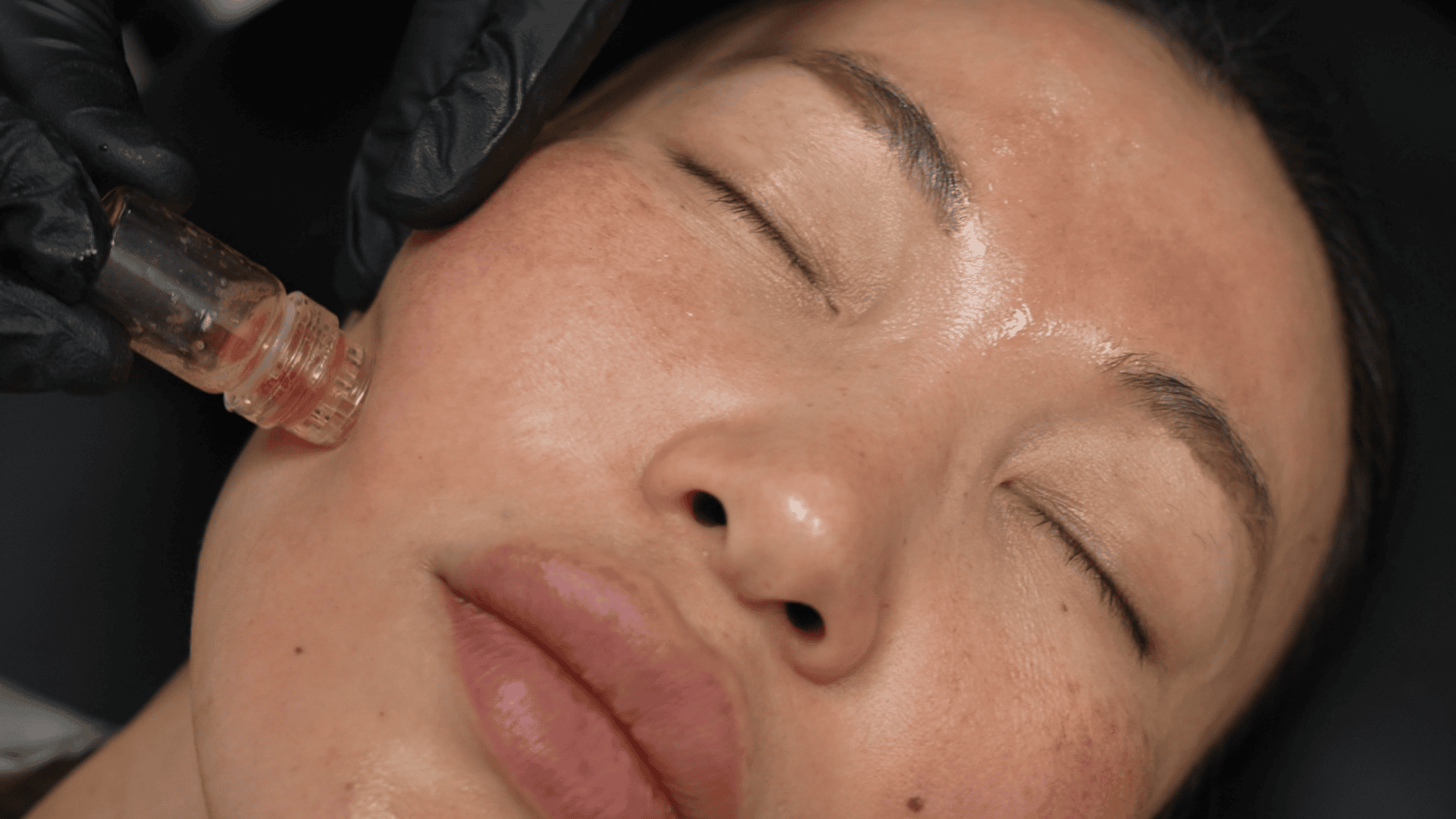 Atelier Confidence Microinfusion