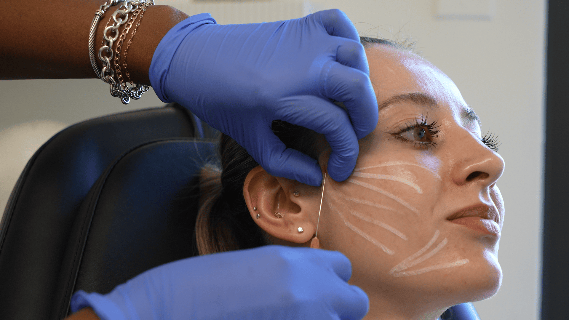 Atelier Confidence Sculptra